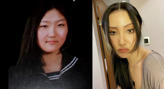 Hwasa before and after picture.